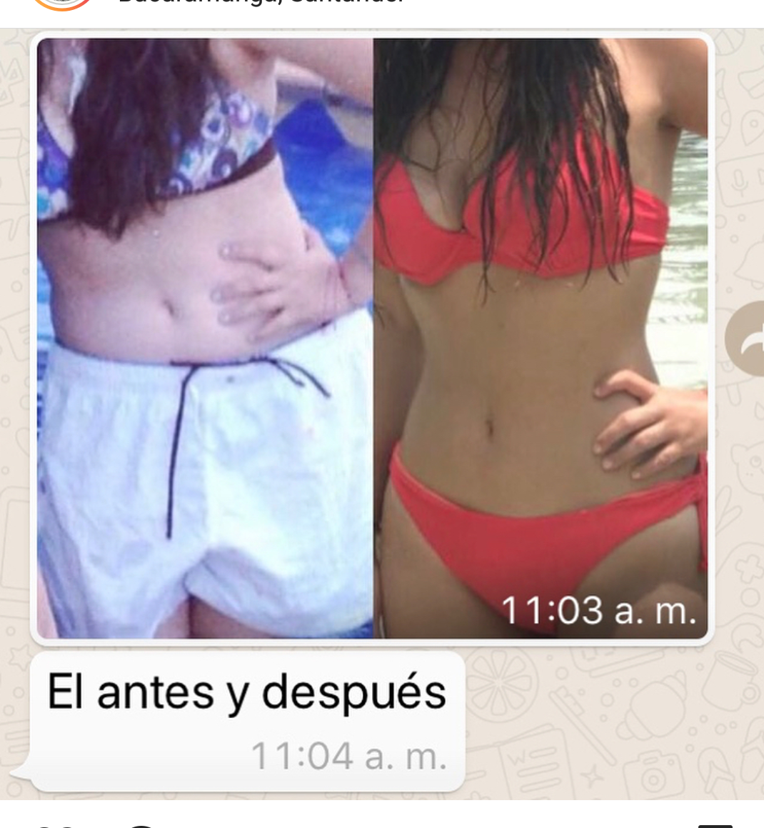 Botiquín Pre-Embarazo perdida de peso