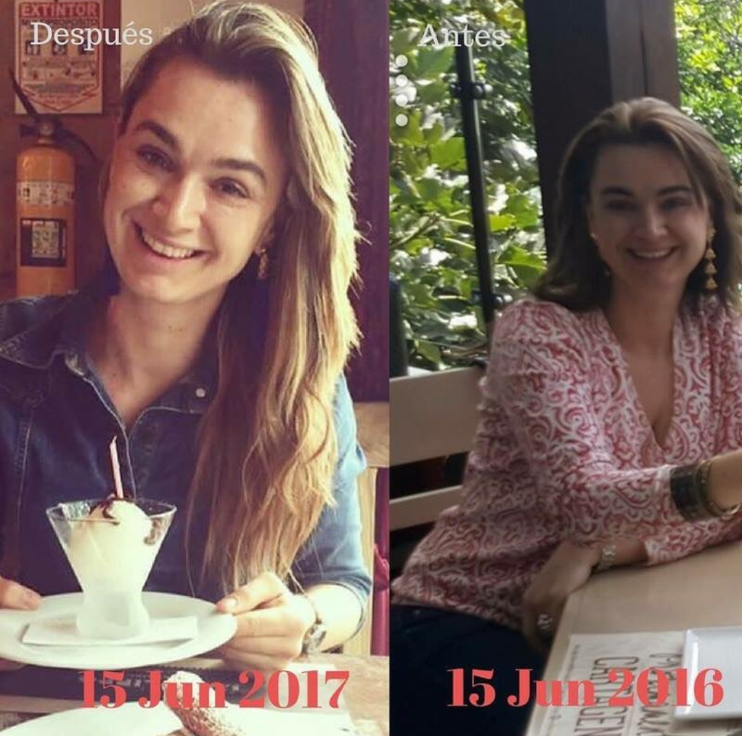 Botiquín Pre-Embarazo perdida de peso