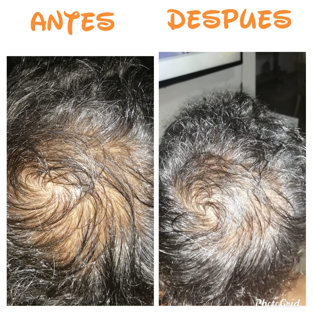 Hair & Skin - Nourish Kit