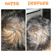 Hair & Skin - Nourish Kit
